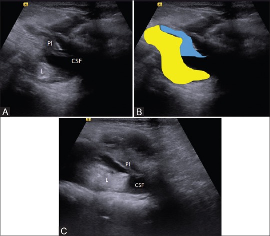 Figure 10 (A-C)