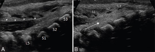 Figure 5 (A and B)