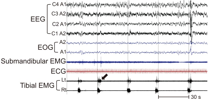 Fig. 3