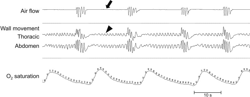 Fig. 2