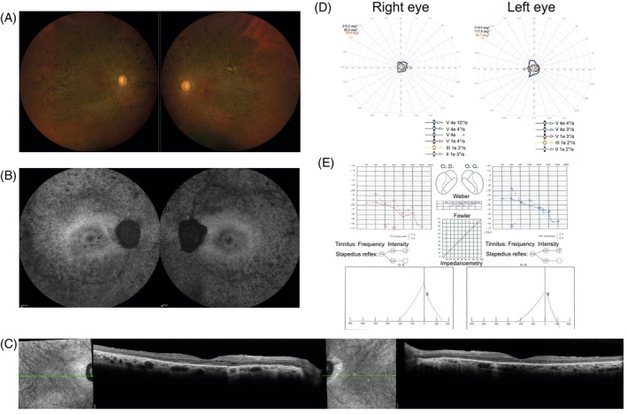 FIGURE 2