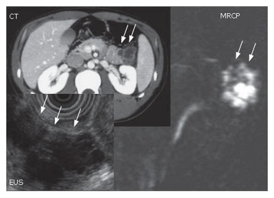 Figure 18