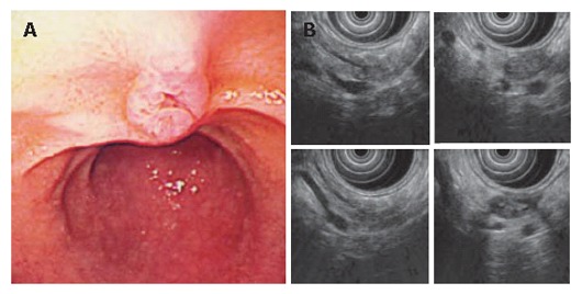 Figure 17