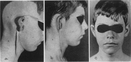 Fig. 4. a,b,c.