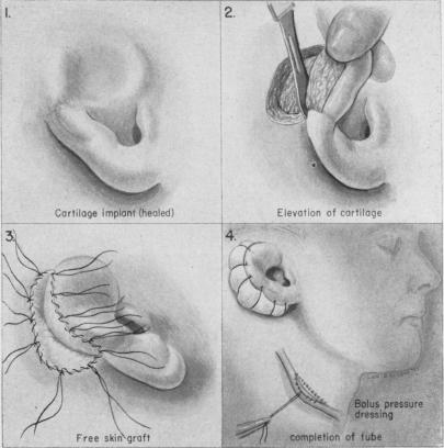 Fig. 10 e.