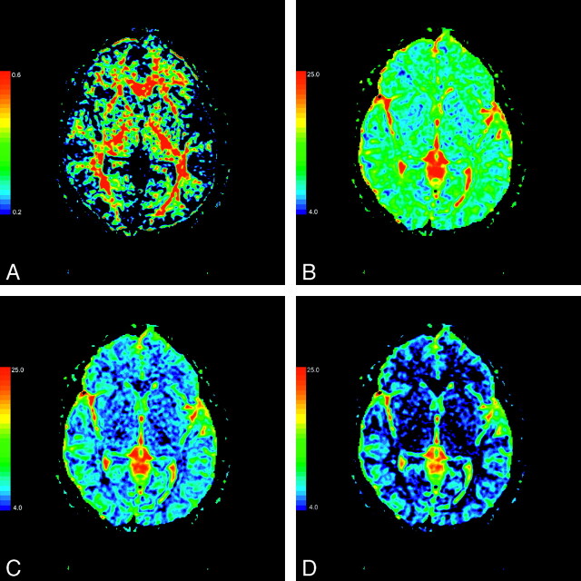 Fig 3.