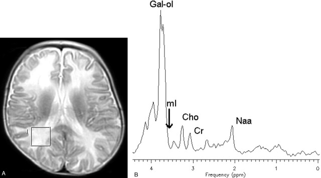 Fig 2.