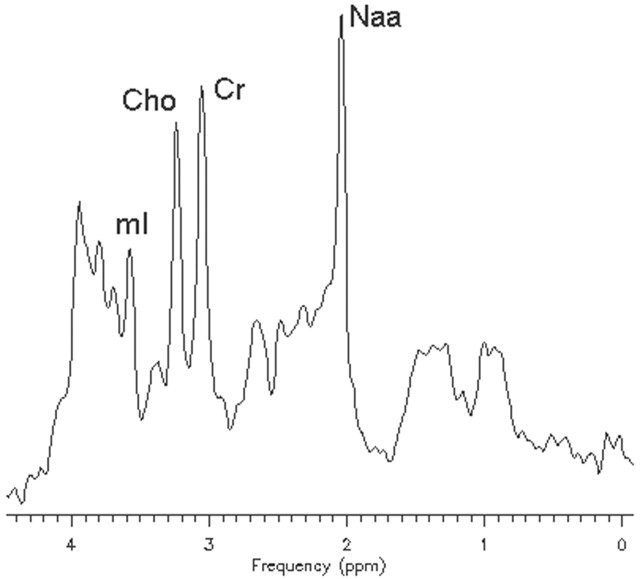 Fig 5.