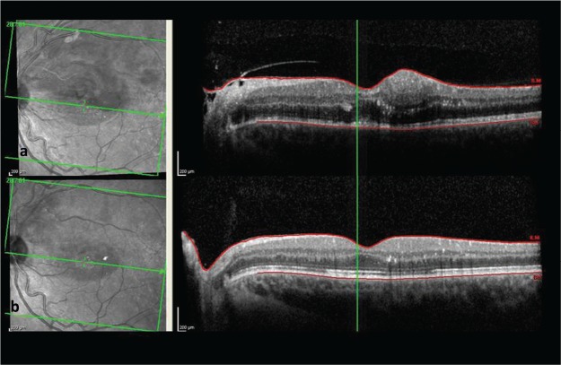 Fig 3.