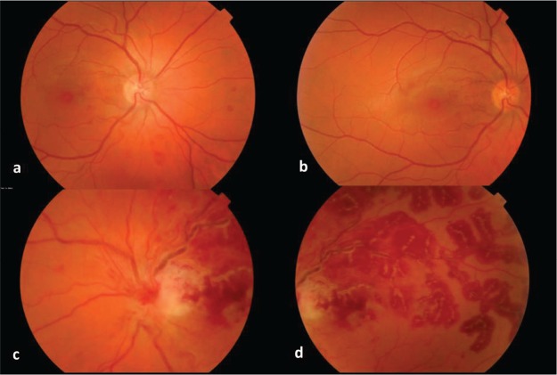 Fig 1.