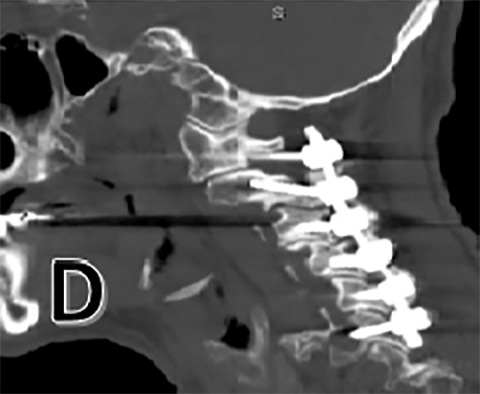 Figure 1 D: