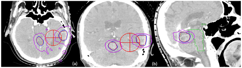 Fig. 4.