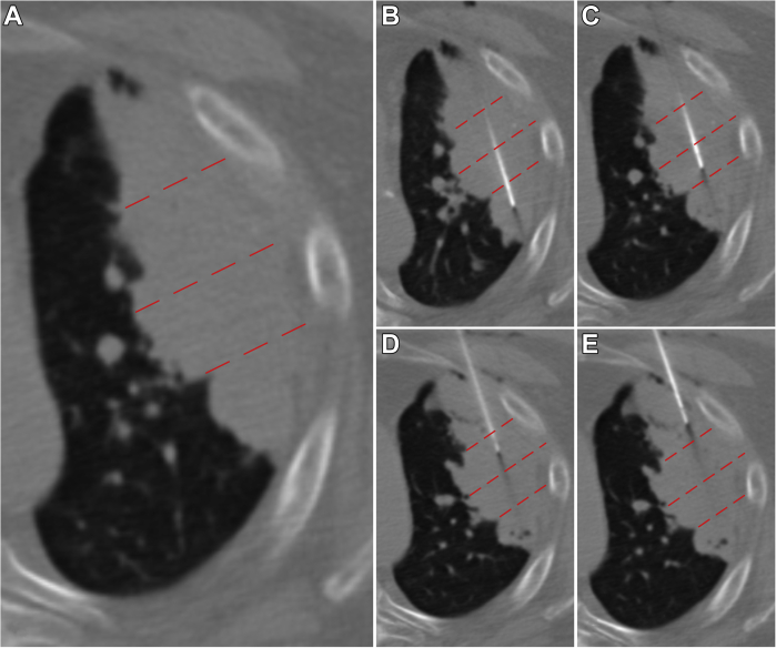 Figure 3