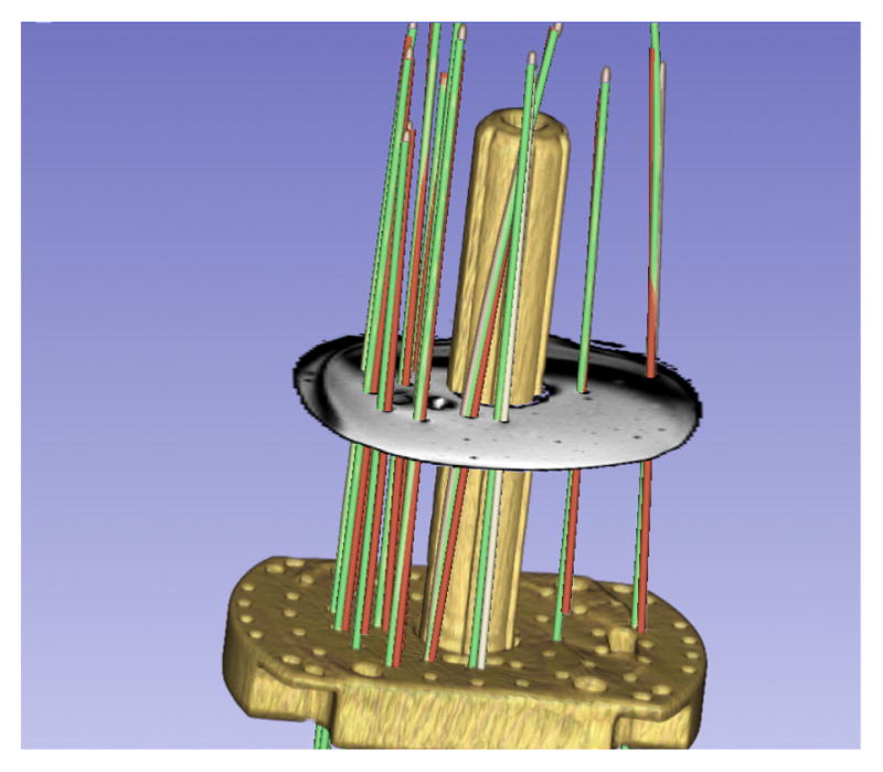 Fig. 3