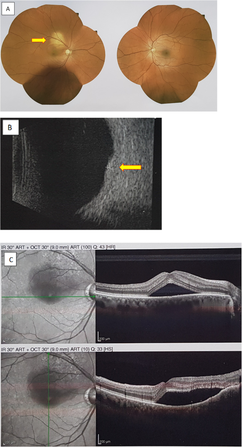 Fig. 2