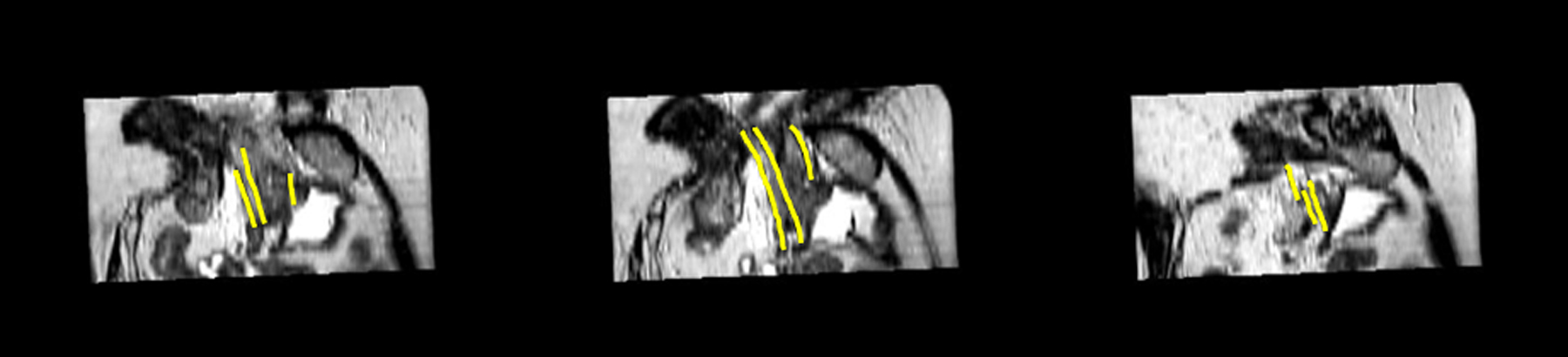 FIG. 3.