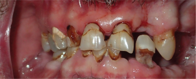  Figure 2. 