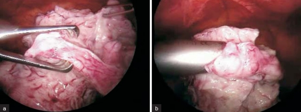 Figure 15 (a-b)