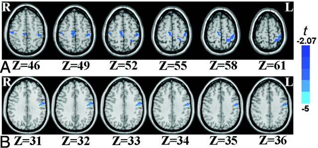 Fig 3.