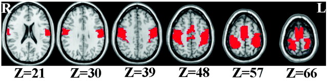 Fig 1.