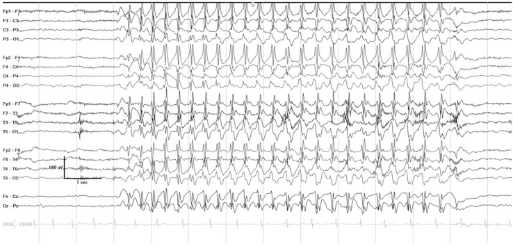 Fig. 1