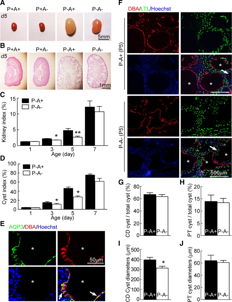 Aquaporin-3 deficiency slows cyst enlargement in experimental mouse ...