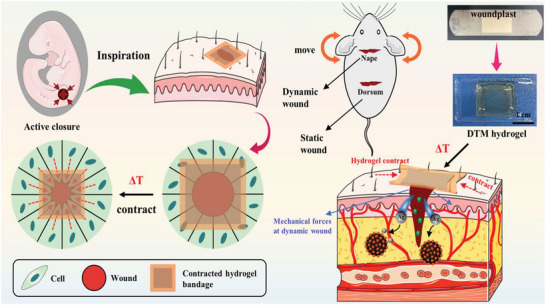 Figure 18