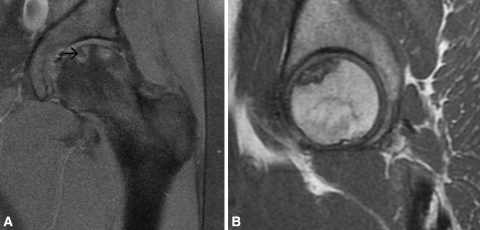 Fig. 3A–B