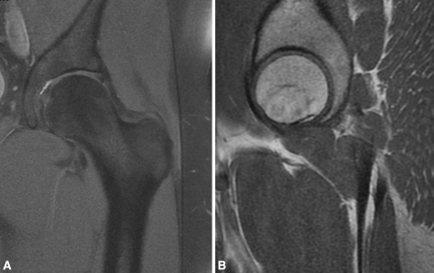 Fig. 1A–B