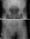 Fig. 2A–B