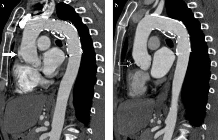 Figure 3. a, b