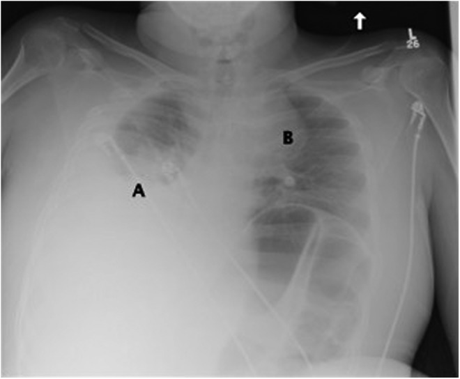 FIG. 1.