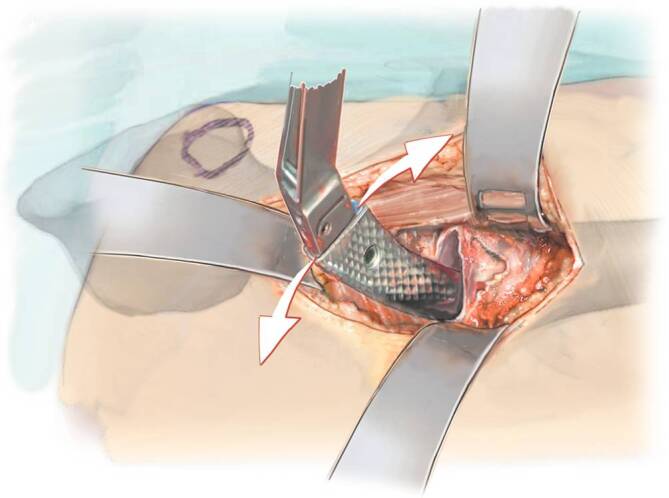 Fig. 15