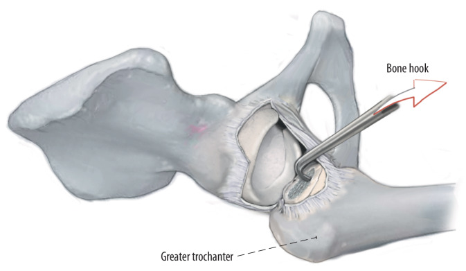 Fig. 12