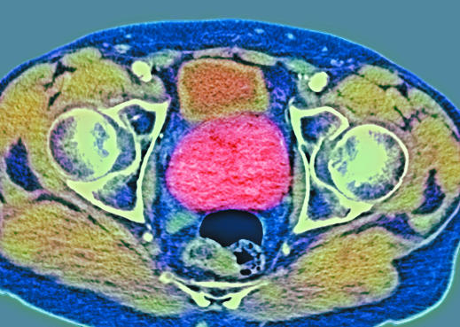 Urological evaluation - PMC