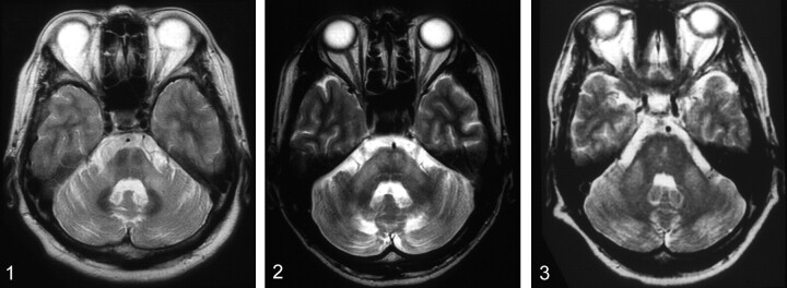 Fig 1.