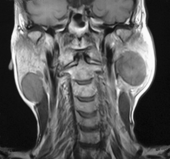 Fig. 3