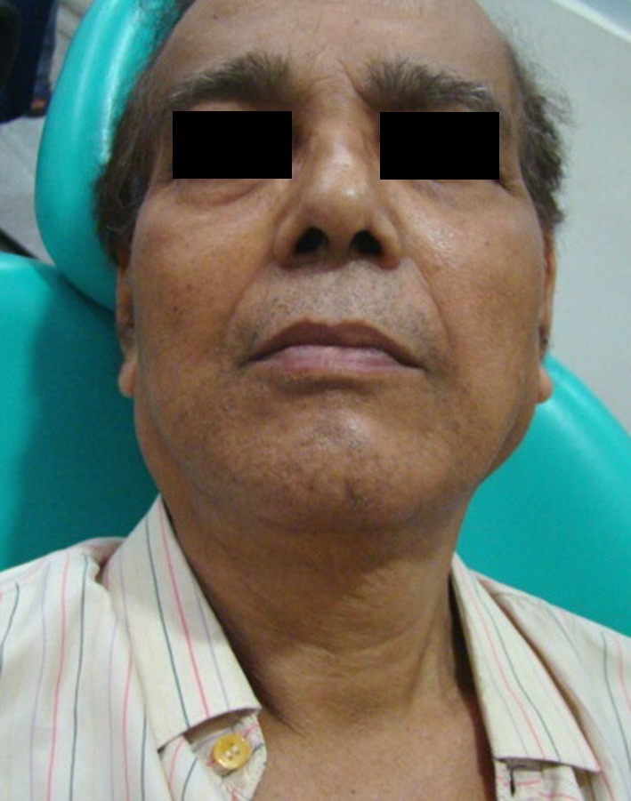 Fig. 1