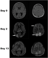 FIGURE 2
