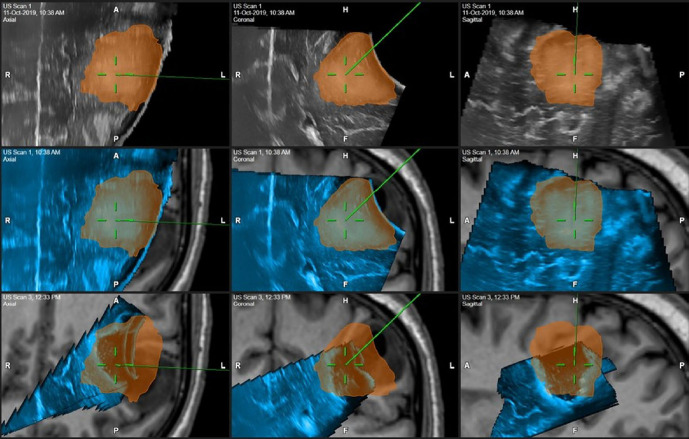 Fig. 14.