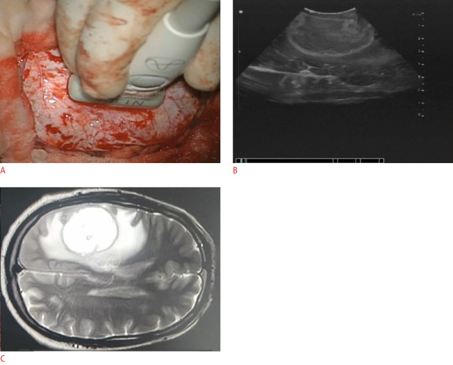 Fig. 5.