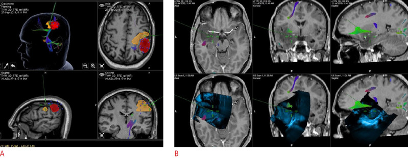 Fig. 9.