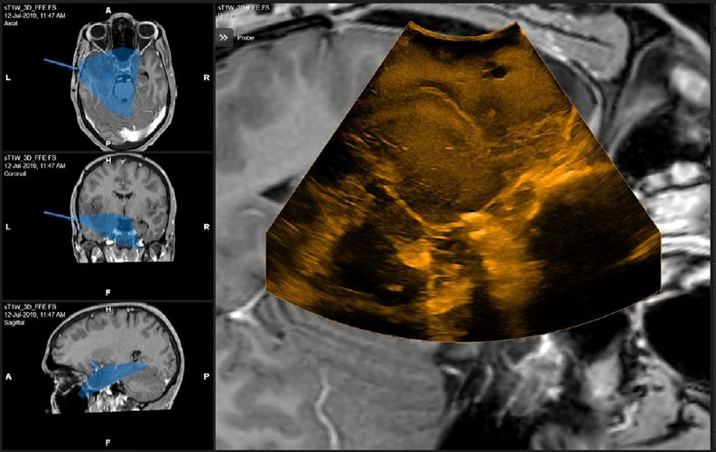 Fig. 6.