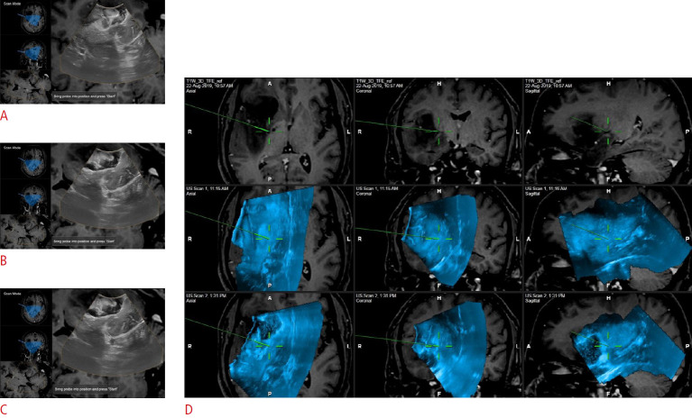 Fig. 12.