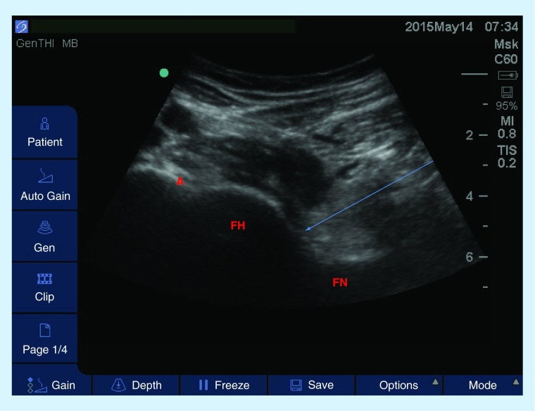 Figure 6. 