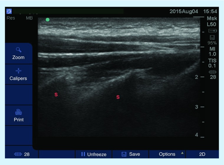 Figure 3. 