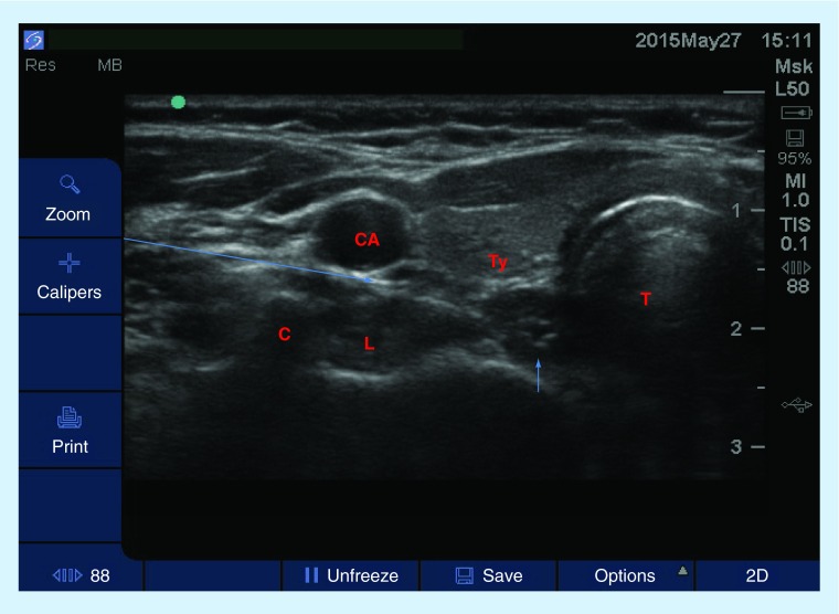 Figure 10. 