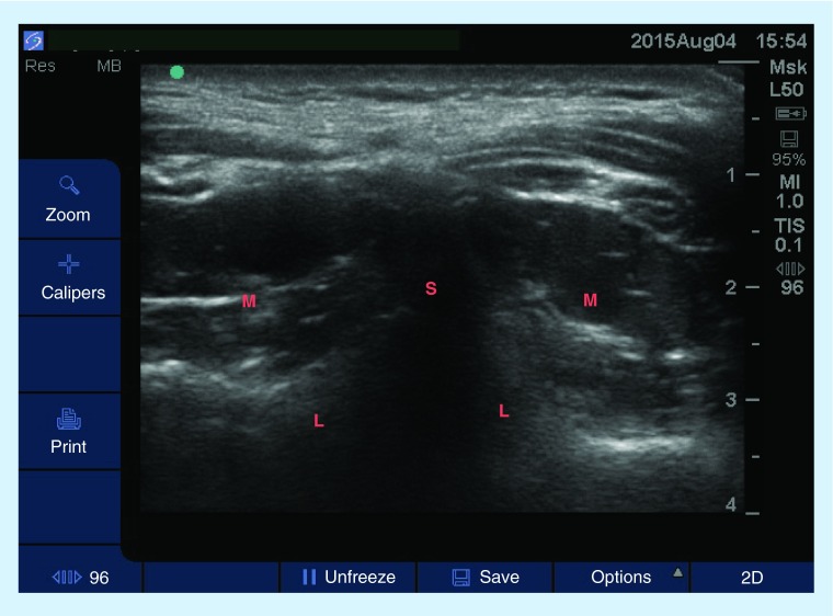 Figure 4. 