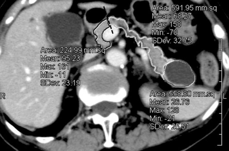 Fig. 1