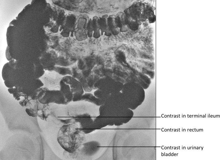 Figure 1